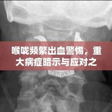 喉咙频繁出血警惕,重大病症暗示与应对之策